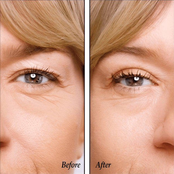 Instant Eye Lift -100 Hypoallergenic Eyelid Lifters Tape, Transparent & Easy-to-Use for a Youthful Look